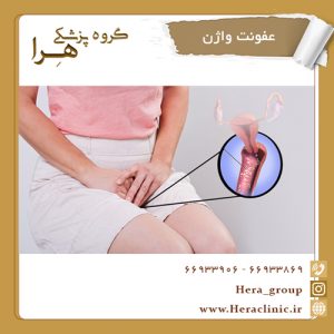 عفونت واژن