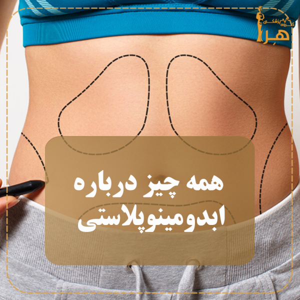 همه چیز درباره جراحی ابدومینوپلاستی